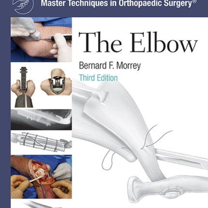 Master Techniques in Orthopaedic Surgery: The Elbow