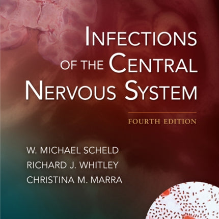 Infections of the Central Nervous System