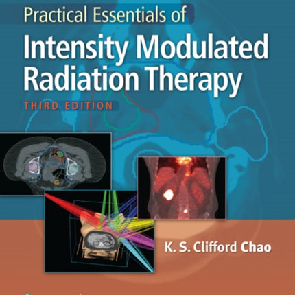 Practical Essentials of Intensity Modulated Radiation Therapy