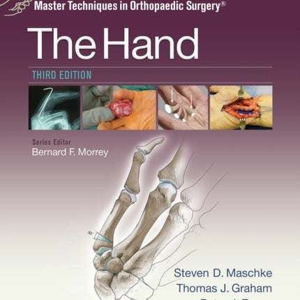 Master Techniques in Orthopaedic Surgery: The Hand