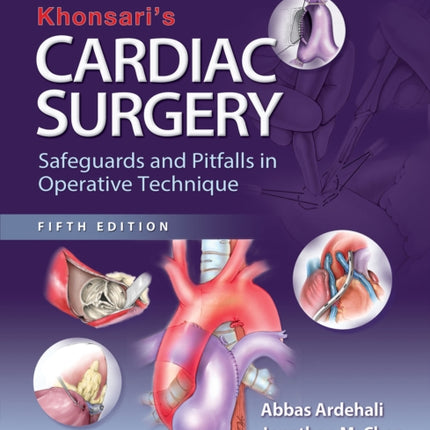 Khonsari's Cardiac Surgery: Safeguards and Pitfalls in Operative Technique