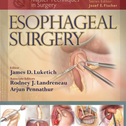 Master Techniques in Surgery: Esophageal Surgery