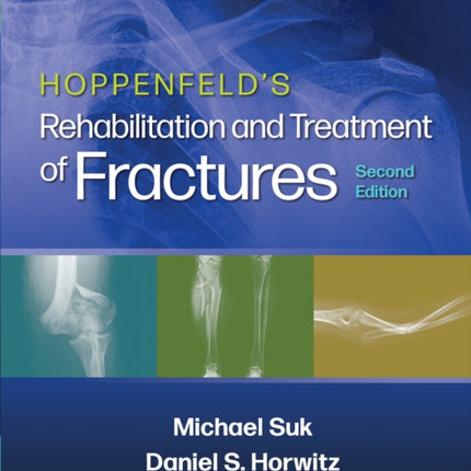 Hoppenfeld's Treatment and Rehabilitation of Fractures