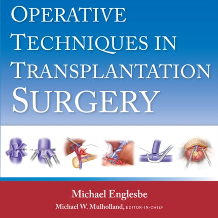 Operative Techniques in Transplantation Surgery