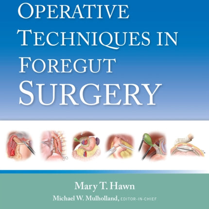 Operative Techniques in Foregut Surgery