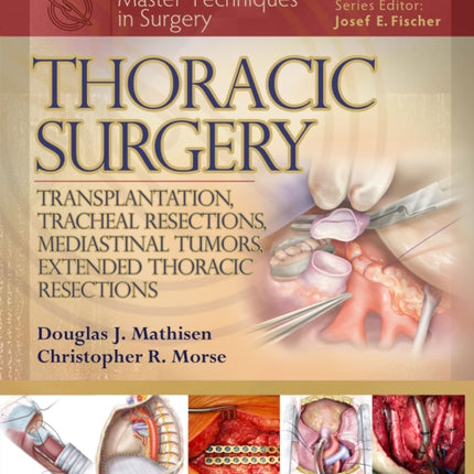 Master Techniques in Surgery: Thoracic Surgery: Transplantation, Tracheal Resections, Mediastinal Tumors, Extended Thoracic Resections