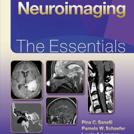 Neuroimaging The Essentials