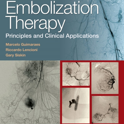 Embolization Therapy: Principles and Clinical Applications