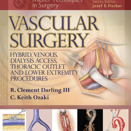 Master Techniques in Surgery: Vascular Surgery: Hybrid, Venous, Dialysis Access, Thoracic Outlet, and Lower Extremity Procedures