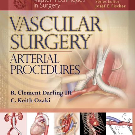 Master Techniques in Surgery Vascular Surgery