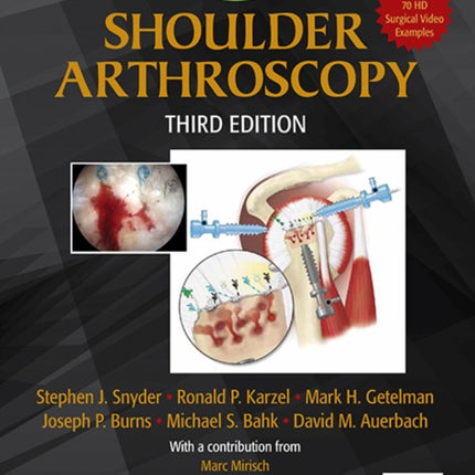 Shoulder Arthroscopy