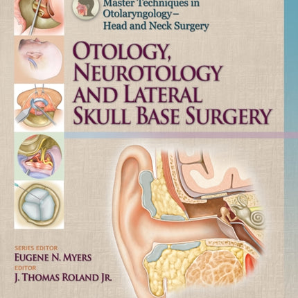 Master Techniques in Otolaryngology – Head and Neck Surgery: Otology, Neurotology, and Lateral Skull Base Surgery