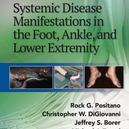 Systemic Disease Manifestations in the Foot, Ankle, and Lower Extremity