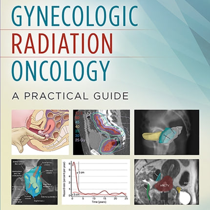 Gynecologic Radiation Oncology: A Practical Guide