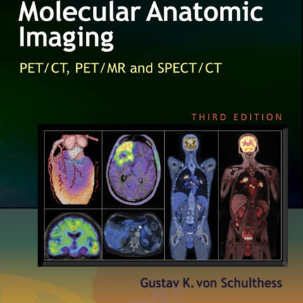 Molecular Anatomic Imaging: PET/CT, PET/MR and SPECT CT