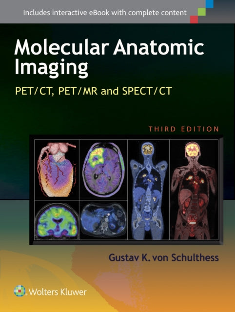 Molecular Anatomic Imaging: PET/CT, PET/MR and SPECT CT