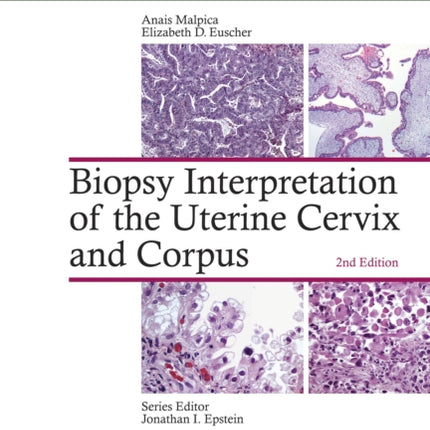 Biopsy Interpretation of the Uterine Cervix and Corpus