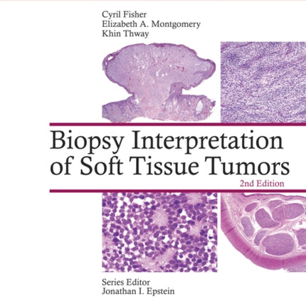 Biopsy Interpretation of Soft Tissue Tumors