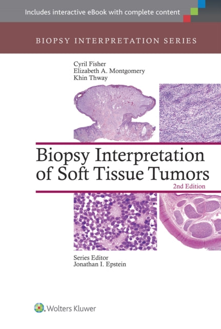 Biopsy Interpretation of Soft Tissue Tumors