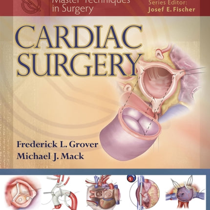 Cardiac Surgery