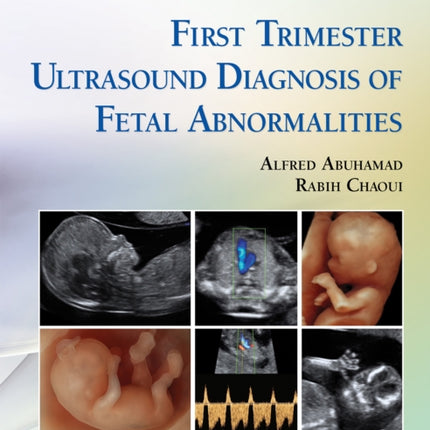 First Trimester Ultrasound Diagnosis of Fetal Abnormalities