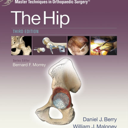 Master Techniques in Orthopaedic Surgery: The Hip