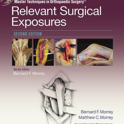 Master Techniques in Orthopaedic Surgery: Relevant Surgical Exposures