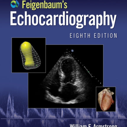 Feigenbaum's Echocardiography