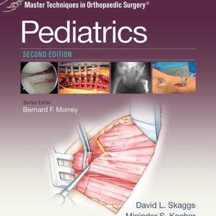 Master Techniques in Orthopaedic Surgery: Pediatrics