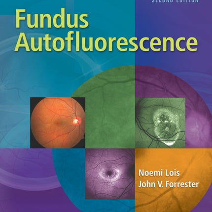 Fundus Autofluorescence