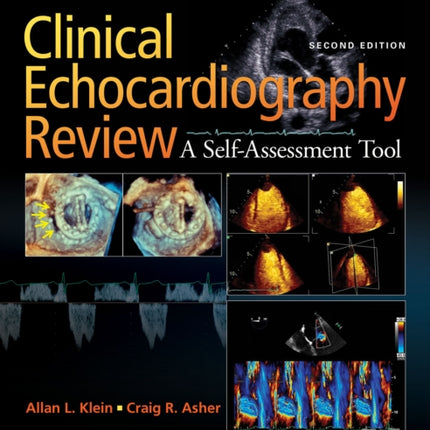 Clinical Echocardiography Review