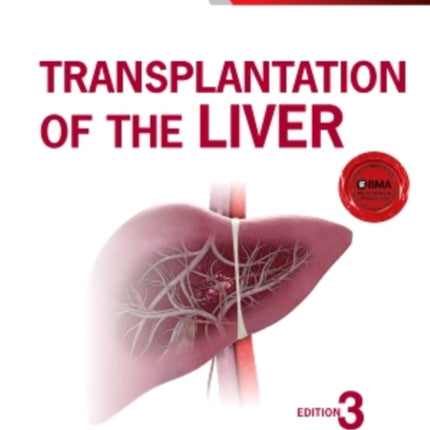 Transplantation of the Liver