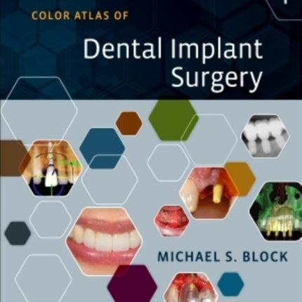 Color Atlas of Dental Implant Surgery