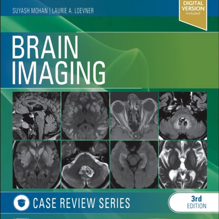 Brain Imaging: Case Review Series