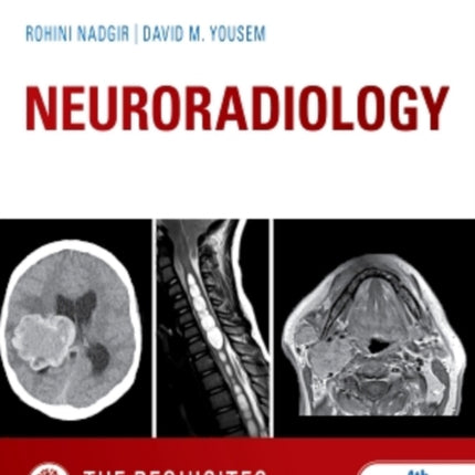 Neuroradiology: The Requisites