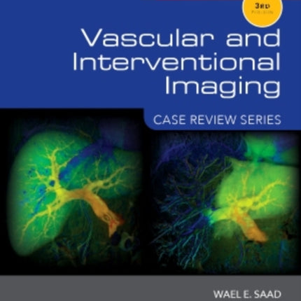 Vascular and Interventional Imaging Case Review