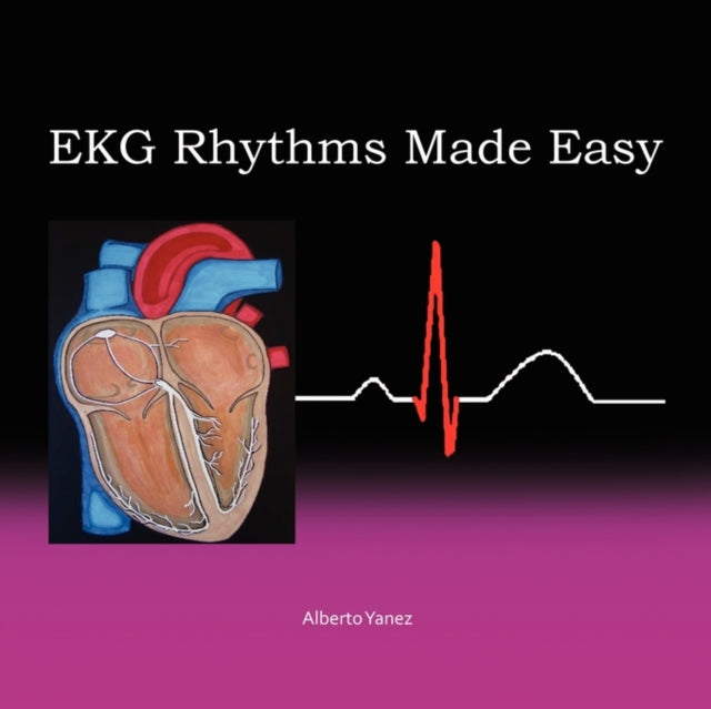 EKG Rhythms Made Easy