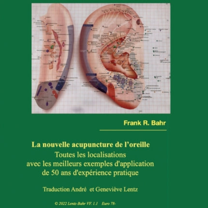 La nouvelle acupuncture de loreille