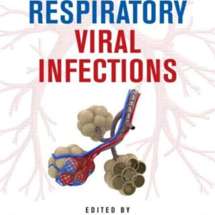 Human Respiratory Viral Infections