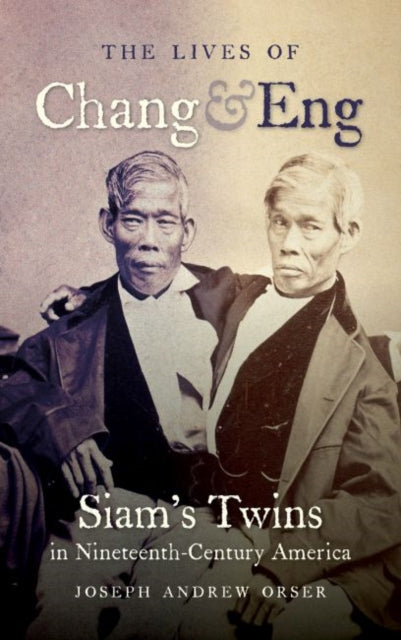 Lives of Chang and Eng Siams Twins in