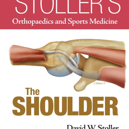 Stoller’s Orthopaedics and Sports Medicine: The Shoulder