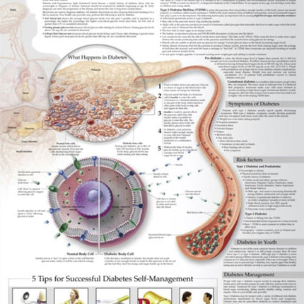 Understanding Diabetes Anatomical Chart