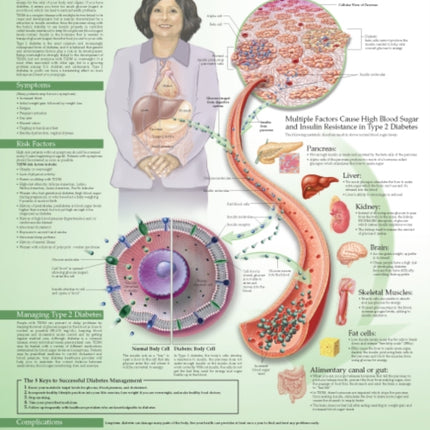 Understanding Type 2 Diabetes Anatomical Chart