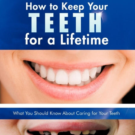 How to Keep Your Teeth for a Lifetime What You Should Know about Caring for Your Teeth