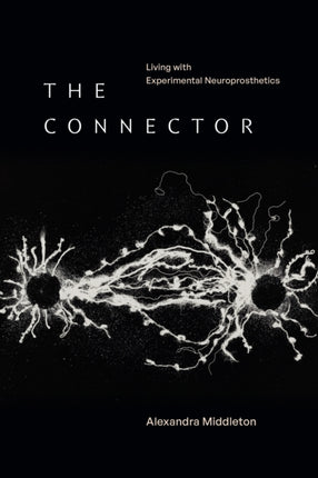 The Connector  Living with Experimental Neuroprosthetics