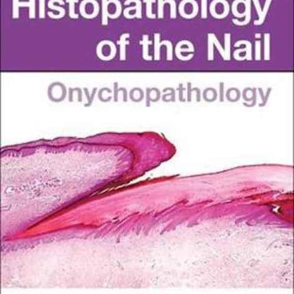 Histopathology of the Nail