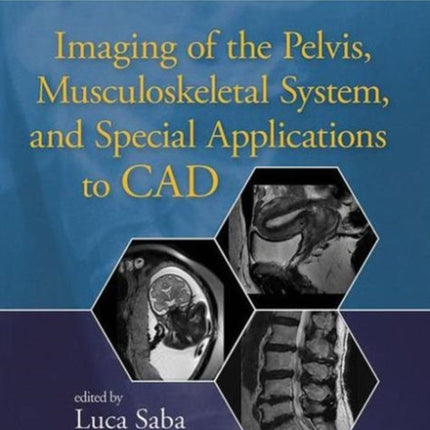 Imaging of the Pelvis, Musculoskeletal System, and Special Applications to CAD