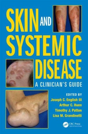 Skin and Systemic Disease: A Clinician’s Guide