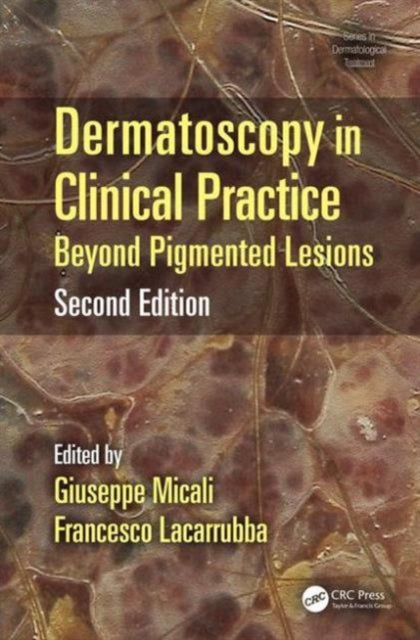 Dermatoscopy in Clinical Practice: Beyond Pigmented Lesions