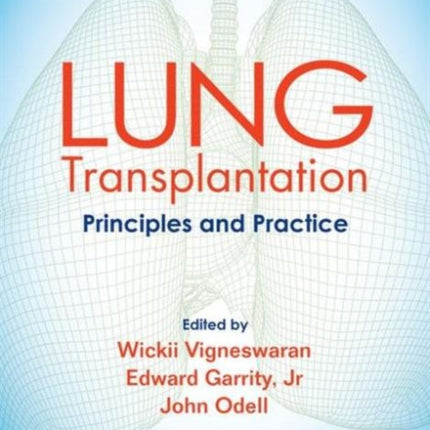 Lung Transplantation: Principles and Practice